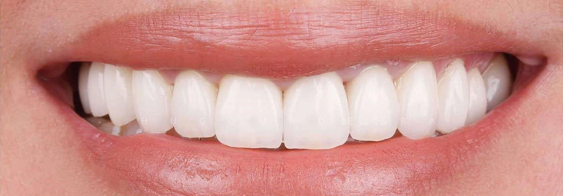 Після чистки